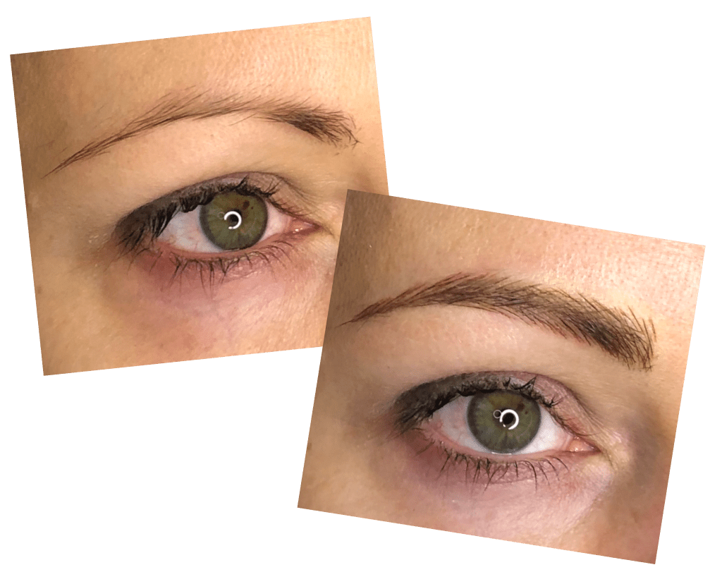 Brow Before and After